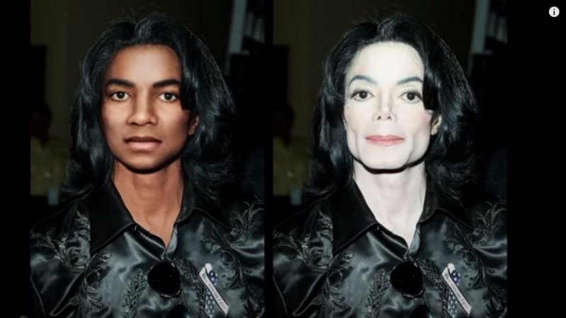 Michael Jackson: Χωρίς Πλαστικές επεμβάσεις