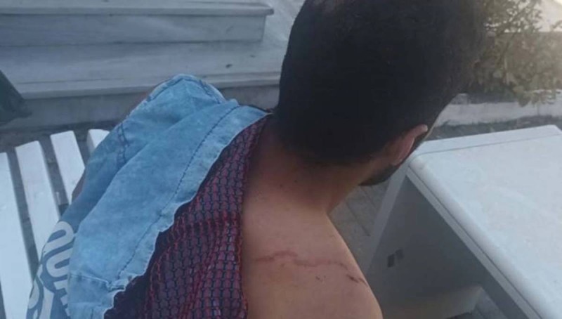 Σοκ στην Κρήτη: Θύμα άγριου ξυλοδαρμού έπεσε εργαζόμενος, επειδή ζήτησε από τον εργοδότη τα δεδουλευμένα του