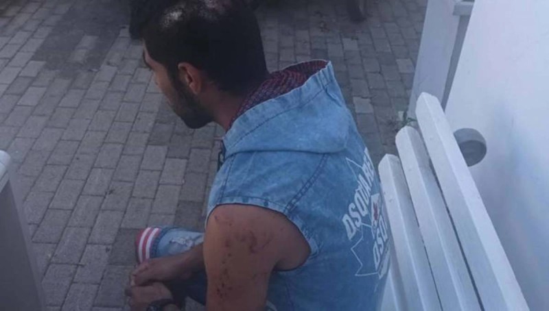Σοκ στην Κρήτη: Θύμα άγριου ξυλοδαρμού έπεσε εργαζόμενος, επειδή ζήτησε από τον εργοδότη τα δεδουλευμένα του